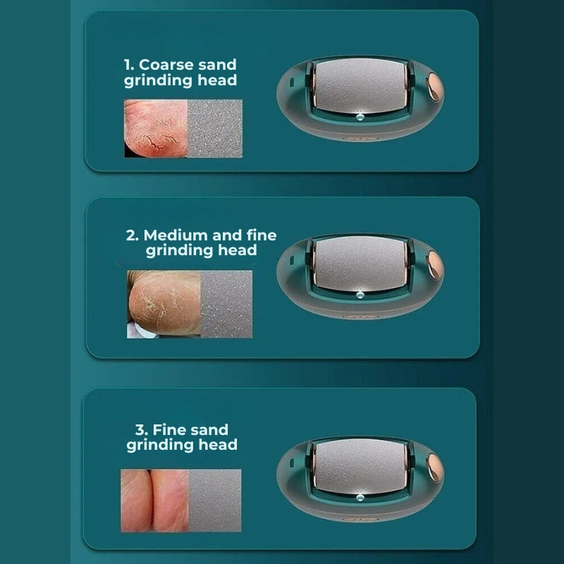 Electric Foot File – Smooth, Recharge & Glow