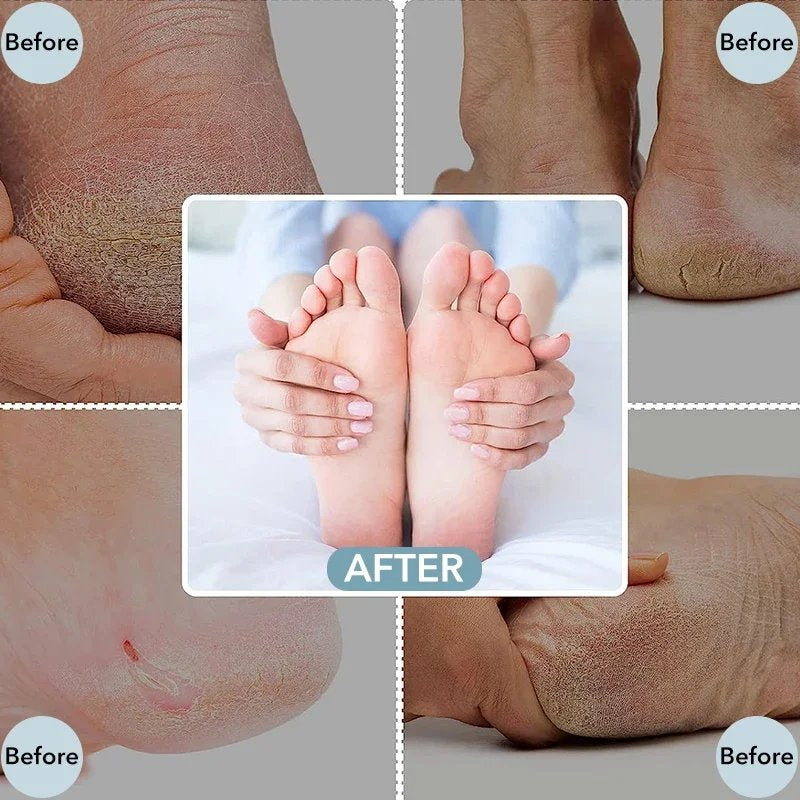 Pro Foot File – Smooth, Buff & Glow Instantly